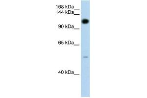 PUM2 antibody used at 1. (PUM2 antibody)