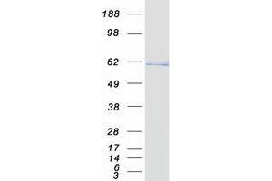 Validation with Western Blot (TRF2 Protein (Myc-DYKDDDDK Tag))