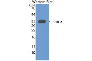 Western blot analysis of the recombinant protein. (Plexin A1 antibody  (AA 43-300))