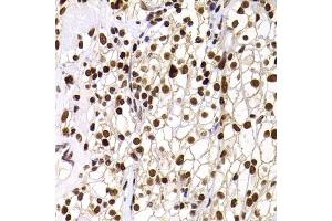 Immunohistochemistry (IHC) image for anti-Pleckstrin Homology Domain Interacting Protein (PHIP) (AA 1542-1821) antibody (ABIN6145556)