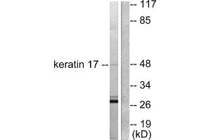 Western blot analysis of extracts from HuvEc cells, using keratin 17 antibody (ABIN5976437).