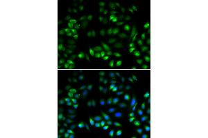 Immunofluorescence analysis of U2OS cells using MANF antibody (ABIN5974212). (MANF antibody)