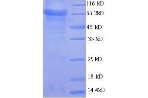 SDS-PAGE (SDS) image for Acetylcholinesterase (AChE) (AA 31-613) protein (GST tag) (ABIN5708991) (Acetylcholinesterase Protein (AChE) (AA 31-613) (GST tag))
