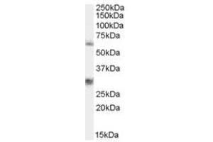 Image no. 1 for anti-Membrane Protein, Palmitoylated 6 (MAGUK P55 Subfamily Member 6) (MPP6) (N-Term) antibody (ABIN374387)