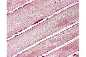 Anti-GLUT4 antibody IHC of human skeletal muscle. (GLUT4 antibody  (AA 498-509))