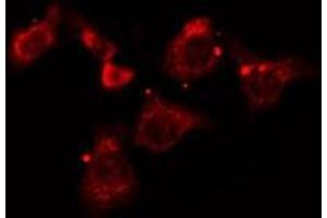 ABIN6277182 staining A549 cells by IF/ICC. (Dynamitin antibody  (C-Term))