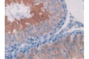 Detection of SDH in Rat Testis Tissue using Polyclonal Antibody to Sorbitol Dehydrogenase (SDH) (SORD antibody  (AA 2-357))