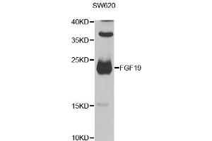 Western blot analysis of extracts of SW620 cells, using FGF19 antibody (ABIN2562584) at 1:1000 dilution.