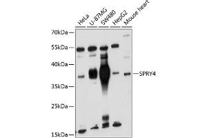 Western blot analysis of extracts of various cell lines, using SPRY4 antibody (ABIN6132548, ABIN6148395, ABIN6148396 and ABIN6221865) at 1:1000 dilution. (SPRY4 antibody  (AA 30-210))