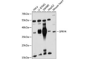 Western blot analysis of extracts of various cell lines, using SPRY4 antibody (ABIN6132548, ABIN6148395, ABIN6148396 and ABIN6221865) at 1:1000 dilution.