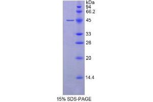 SDS-PAGE (SDS) image for Glutathione Peroxidase 4 (GPX4) (AA 74-197) protein (His tag,GST tag) (ABIN2122913) (GPX4 Protein (AA 74-197) (His tag,GST tag))