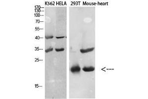 Western Blot (WB) analysis of specific cells using Antibody diluted at 1:1000. (CCL27 antibody)