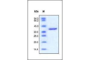 Human IGF-II, Fc Tag on SDS-PAGE under reducing (R) condition. (IGF2 Protein (AA 25-91) (Fc Tag))