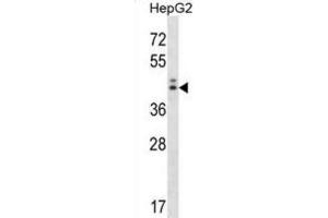 Western Blotting (WB) image for anti-Neuroguidin, EIF4E Binding Protein (NGDN) antibody (ABIN2998327)