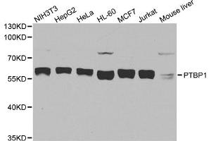 Western blot analysis of extracts of various cell lines, using PTBP1 antibody (ABIN5995415) at 1/1000 dilution. (PTBP1 antibody)