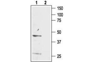 Western blot analysis of mouse brain lysate:1. (Bombesin Receptor 3 Peptide)