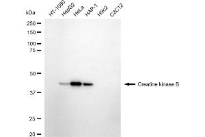 Western blotting analysis using creatine kinase B antibody (ABIN7798162).