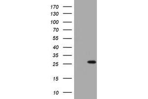 Image no. 1 for anti-BCL2/adenovirus E1B 19kDa Interacting Protein 1 (BNIP1) (AA 1-199) antibody (ABIN1490606) (BNIP1 antibody  (AA 1-199))