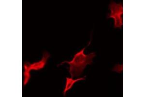 ABIN6266476 staining 293 by IF/ICC. (CSF1R antibody  (Internal Region))
