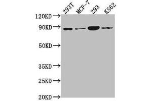 Western Blot Positive WB detected in: 293T whole cell lysate, MCF-7 whole cell lysate, 293 whole cell lysate, K562 whole cell lysate All lanes: P0C869 antibody at 1:2000 Secondary Goat polyclonal to rabbit IgG at 1/50000 dilution Predicted band size: 88, 101, 55, 115 kDa Observed band size: 88 kDa (PLA2G4B antibody  (AA 514-781))