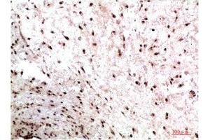 Immunohistochemical analysis of paraffin-embedded Human Colon Carcinoma Tissue using HP-1γ Mouse mAb diluted at 1:200. (CBX3 antibody)