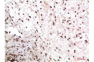 Immunohistochemical analysis of paraffin-embedded Human Colon Carcinoma Tissue using HP-1γ Mouse mAb diluted at 1:200. (CBX3 antibody)