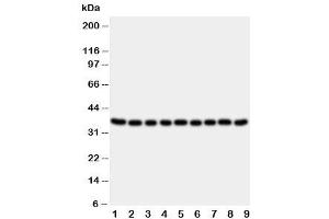 Western blot testing of Kallikrein 10 antibody and Lane 1:  rat ovary (Kallikrein 10 antibody  (C-Term))