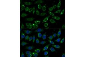 Immunofluorescence analysis of L929 cells using  Polyclonal Antibody  at dilution of 1:100 (40x lens). (ALDH3A2 antibody  (AA 250-320))