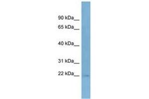 Image no. 1 for anti-Taspase, Threonine Aspartase, 1 (TASP1) (C-Term) antibody (ABIN6742150) (TASP1 antibody  (C-Term))