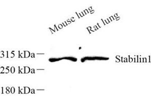 Western blot analysis of Stabilin1 (ABIN7075722) at dilution of 1: 500 (Stabilin 1 antibody)