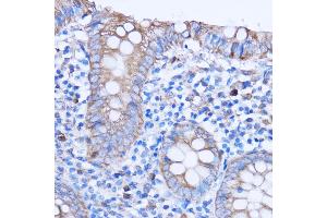 Immunohistochemistry (IHC) image for anti-Mitochondrially Encoded NADH Dehydrogenase 3 (MT-ND3) antibody (ABIN7268601)