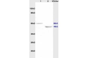 Lane 1: rat brain lysates Lane 2: rat heart lysates probed with Anti KCNN4 Polyclonal Antibody, Unconjugated (ABIN719786) at 1:200 in 4 °C. (KCNN4 antibody  (AA 325-427))
