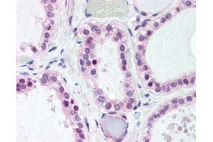 Immunohistochemistry (IHC) image for anti-Wingless-Type MMTV Integration Site Family, Member 4 (WNT4) (Internal Region) antibody (ABIN1049477)