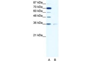 Western Blotting (WB) image for anti-Zinc Finger Protein 326 (ZNF326) antibody (ABIN2460311) (ZNF326 antibody)