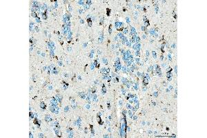 IHC analysis of SIAE using anti-SIAE antibody (ABIN7600774). (SIAE antibody  (AA 230-523))