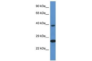Western Blot showing XRCC3 antibody used at a concentration of 1 ug/ml against ACHN Cell Lysate (XRCC3 antibody  (C-Term))