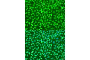 Immunofluorescence analysis of U2OS cells using HOXB5 antibody (ABIN7267769) at dilution of 1:100. (HOXB5 antibody  (AA 1-170))