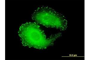 Immunofluorescence of monoclonal antibody to TNS4 on HeLa cell. (Tensin 4 antibody  (AA 1-480))