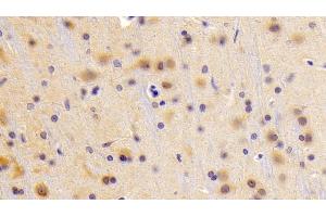 Detection of XRN1 in Rat Cerebrum Tissue using Polyclonal Antibody to 5'-3'Exoribonuclease 1 (XRN1) (XRN1 antibody  (AA 1567-1723))