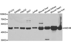 Western blot analysis of extracts of various cell lines, using HADHB antibody (ABIN5973344) at 1/1000 dilution. (HADHB antibody)