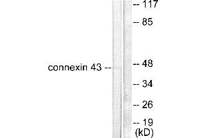 Western blot analysis of extracts from A549 cells, using Connexin 43 antibody. (Connexin 43/GJA1 antibody)