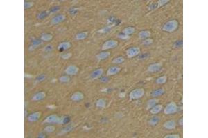 Figure. (KIF5B antibody  (AA 9-226))