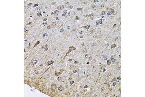 Immunohistochemistry of paraffin-embedded rat brain using DRD3 Antibody. (DRD3 antibody)