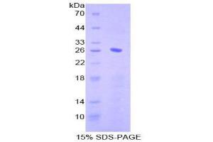 SDS-PAGE (SDS) image for CD79b Molecule, Immunoglobulin-Associated beta (CD79B) (AA 37-226) protein (His tag) (ABIN1879155)
