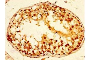 IHC image of ABIN7171412 diluted at 1:800 and staining in paraffin-embedded human testis tissue performed on a Leica BondTM system. (TCP1 alpha/CCTA antibody  (AA 406-506))