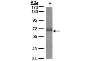 WB Image Sample(30 ug whole cell lysate) A:Hep G2 , 7. (SUOX antibody)