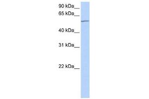MTA3 antibody used at 0. (MTA3 antibody  (C-Term))