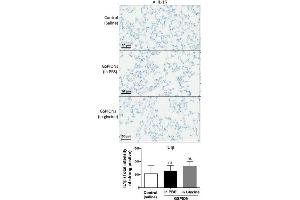 GSPIONs do not increase expression of pro-inflammatory cytokines in lung parenchyma. (IL-1 beta antibody  (AA 101-200))