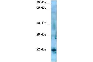 WB Suggested Anti-SSX5 Antibody   Titration: 1. (SSX5 antibody  (C-Term))