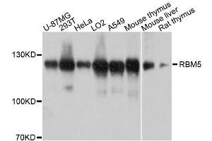 Western blot analysis of extracts of various cell lines, using RBM5 antibody. (RBM5 antibody  (AA 1-130))